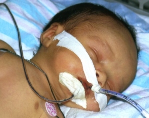 Noah Caiden Brown, son of Cassie Sheffied, died from a blood clot after two weeks of life