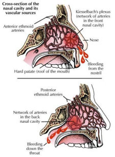 anatomy of a nosebleed